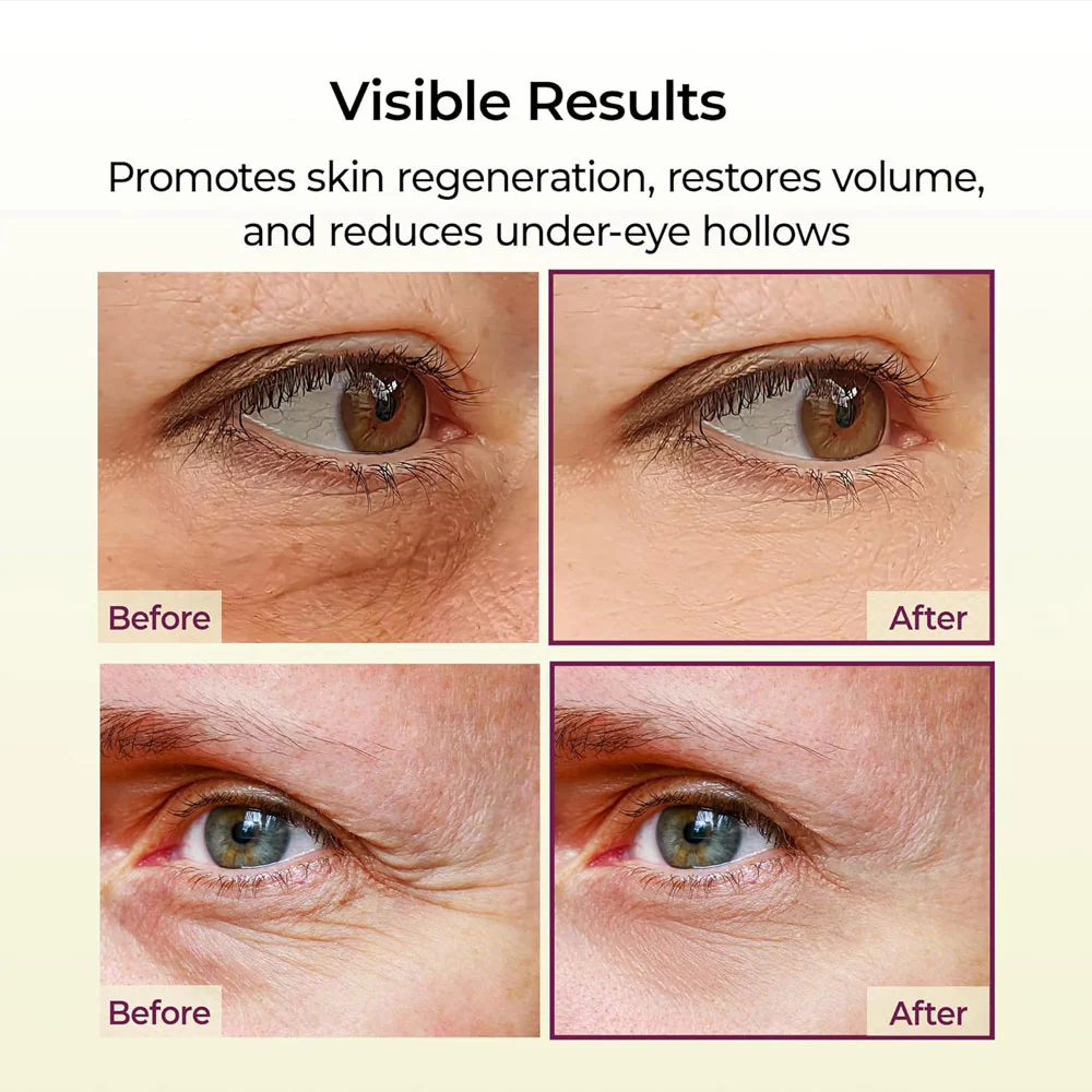 Dr.Melaxin Cemenrete Calcium Volume Multi Balm