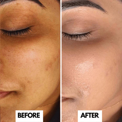 O3+ Professional Bridal Facial Kit - Single Use Vitamin-C Glowing Skin Treatment with D-Tan Pack