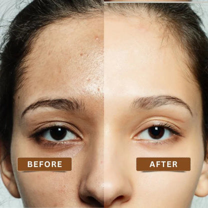 O3+ Professional Bridal Facial Kit - Single Use Vitamin-C Glowing Skin Treatment with D-Tan Pack