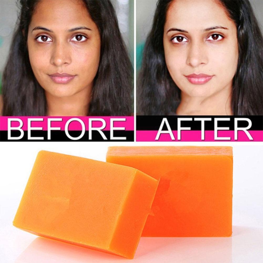 GUANJING Kojic Acid Soap